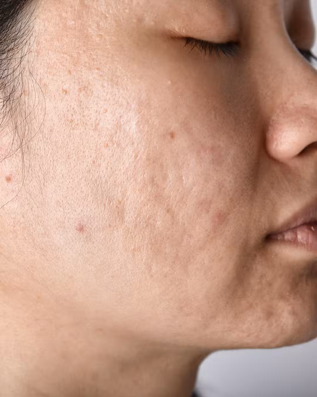 Before Results By Nature Consultation