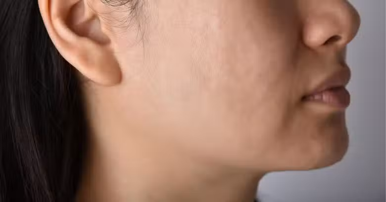 After Results By Nature Consultation